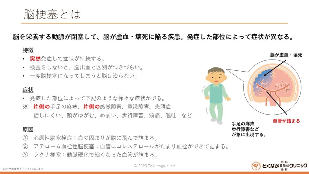 脳梗塞 のイメージ画像